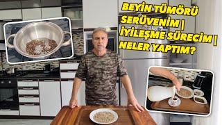 BEYİN TÜMÖRÜM  BAŞTAN SONA MERAK ETTİĞİNİZ SORULARA GÖRSEL CEVAPLAR