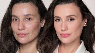 Ive tried different methods and this is the best way to cover melasma  ALI ANDREEA