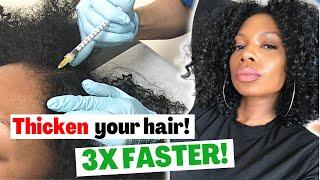 Best Way To Thicken Your Hair 3X FASTER