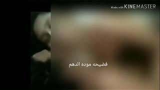 اجمد فضيحة لا مودة الدهم