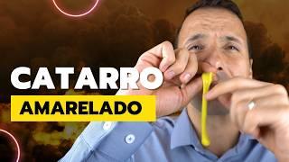 CATARRO AMARELADO ESVERDEADO O QUE FAZER PARA MELHORAR?