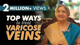 Get rid of Varicose veins  Dr. Hansaji Yogendra