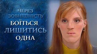 Люди меня боятся Тяжелая жизнь героини на ток-шоу  Говорить Україна. Архів