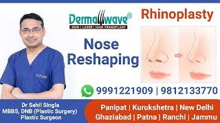 Rhinoplasty Surgery  Rhinoplasty Cost  Nose Reshaping In Delhi NCR  Panipat Jammu Patna Ranchi