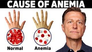 The Hidden Cause of Anemia Youve Never Heard About