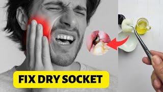 Fix Dry Socket Pain At Home – Dry Socket Relief Treatment At Home