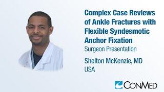 Dr. Shelton McKenzie - PRESENTATION2023 Ankle Fractures with Flexible Syndesmotic Anchor Fixation