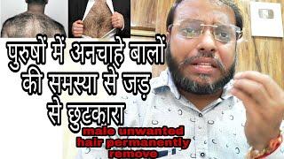 पुरुषों में अनचाहे बालों की समस्या से जड़ से छुटकारा।Male unwanted hair permanently remove