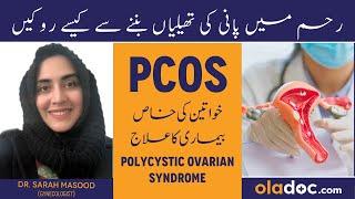 What is PCOS Kya Hai In UrduHindi - PCOS Treatment - How to Treat PCOS ka Ilaj - PCOS Symptoms