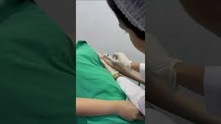 Dəri altı implant