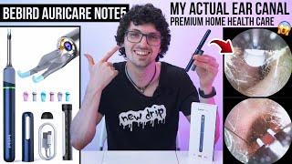 Bebird AuriCare Note5 Pro Review A Health Care Must-Have Otoscope Tweezer & Live Video Sharing