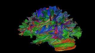 Networks in the brain mapping the connectome