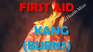 Kang burns First aid - Mizo