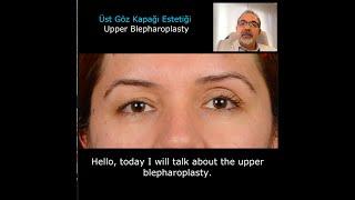 Üst Göz Kapağı Estetiği Blepharoplasty - Blefaroplasti Adana