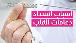 Stent  أسباب انسداد دعامات القلب