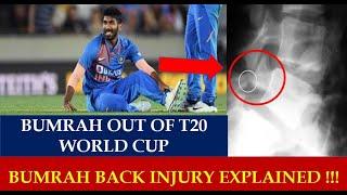 Jasprit Bumrah Back Injury Explained - Bumrah out of T20 world cup