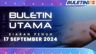 KKM Kesan Satu Kes Positif MPOX Babitkan Warga Malaysia  Buletin Utama 17 September 2024