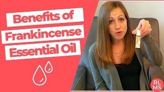 HEALTH BENEFITS OF FRANKINCENSE ESSENTIAL OIL  Benefits for Skin Mental Health Immunity & MORE