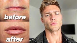 How To Get Bigger More Attractive Lips for guys