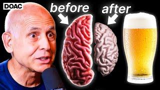 The Ugly Truth About Alcohol’s Effect On Your Brain.  Dr Daniel Amen