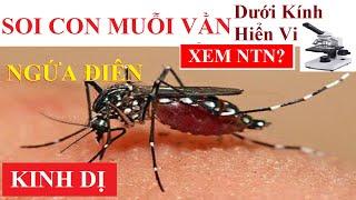 HẬN  Soi Con Muỗi Vằn Dưới Kính Hiển Vi Xem NTN