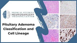 Pituitary Adenoma Classification and Cell Lineage