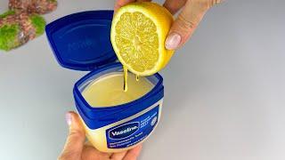 Mix Vaseline with Lemon and you will be shocked If only I had known about this earlier