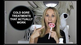 COLD SORE TREATMENTS THAT WORK - NADINE BAGGOTT