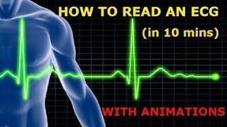 ECG Electro Cardio Gram  How ECG is Performed  Uses Of ECG