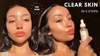 MY UPDATED SKINCARE ROUTINE  unsponsored skincare for acne