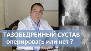 Операция тазобедренного сустава делать или нет. Эндопротезирование.