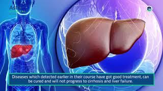 Chronic Liver Diseases & Cirrhosis