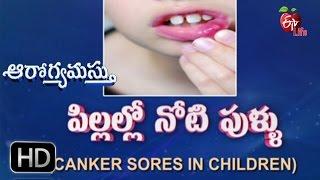 Aarogyamastu  Canker Sores In Children  2nd November 2016  ఆరోగ్యమస్తు