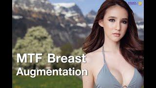 The first MTF transitining surgery of Yoshi Rinrada Miss Tiffany 2017 is a Breast Augmentation