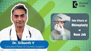 Side Effects Of Rhinoplasty Nose Job #plasticsurgery #rhinoplasty -Dr. Srikanth V Doctors Circle