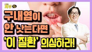 구내염인줄 알고 방치했다가 구강암까지? 입병 제대로 알기 - 박치영의 피부톡톡 #48 구강편평태선