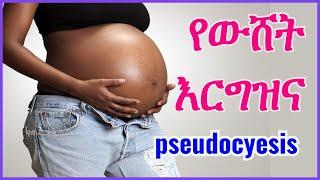 የውሸት እርግዝና #pseudocyesis or #phantom #pregnancy  የጤና ቃል