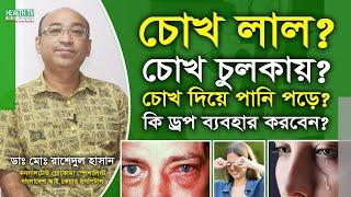 চোখে এলার্জি হলে কি ড্রপ ব্যবহার করবেন  চোখ লাল  চোখ চুলকায়  চোখ দিয়ে পানি পড়া  Health Tv