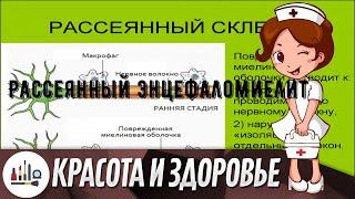 Рассеянный энцефаломиелит