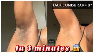 How to Get rid of Dark underarms in 3 minutes instant result