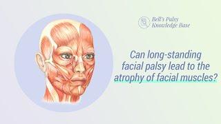 Can long-standing facial palsy lead to the atrophy of facial muscles? - Bells Palsy Video Lectures