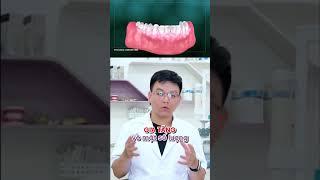 Cô chú có đang gặp tình trạng trên ?  #dentist #cayghepimplant #nhakhoa#implant #nhakhoaseadental