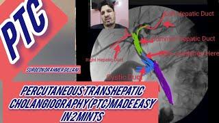 PTCpercutaneous Transhepatic Cholangiography Made Easy
