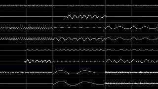 Pokémon HeartGoldSoulSilver - Azalea Town oscilloscope view