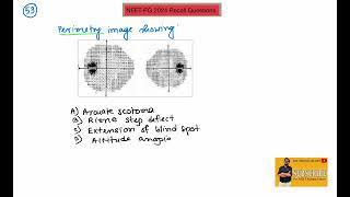 NEET-PG 2024 Recall  Questions no. 51 to 60  Dr. Shankar Dey