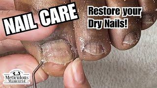 Nail Care Dry Toenails #nails #satisfying 