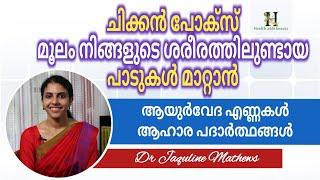 Childre pox marks  Ayurveda Remedy  ചിക്കൻ പോക്സ് മൂലമുണ്ടായ പാടുകൾ മാറ്റാൻ  Dr Jaquline Mathews