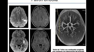 Urgencias en Neuropediatría