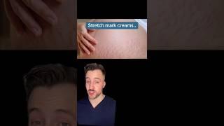 Top Dermatologist Tips for Choosing the Best Stretch Mark Removal Cream#Stretch #Dermatologist Tips