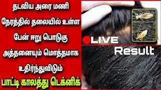 ️ஈறு பேன் பொடுகு தொல்லை நிரந்தரமாக ஒழிய இந்த வீடியோ பாருங்க lice dandruff remedy Fathus Samayal